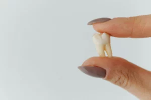 Une dent qui bouge nécessite de prendre rendez-vous à Lausanne